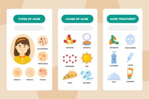 Banner image of Premium Hand-Drawn Acne & Oily Skin Problems Infographic  Free Download